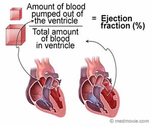 Ejection Fraction